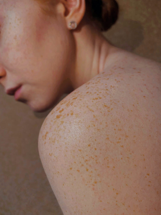 Understanding Skin Sensitivity and Gentle Care